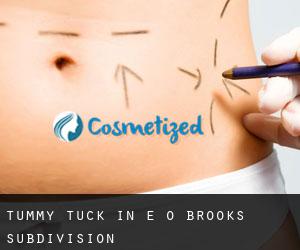 Tummy Tuck in E O Brooks Subdivision