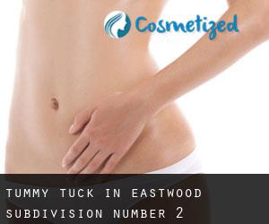 Tummy Tuck in Eastwood Subdivision Number 2