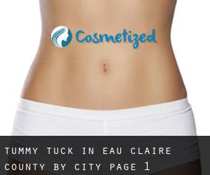 Tummy Tuck in Eau Claire County by city - page 1