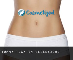 Tummy Tuck in Ellensburg