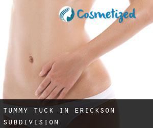 Tummy Tuck in Erickson Subdivision