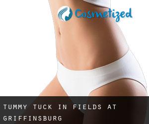 Tummy Tuck in Fields at Griffinsburg