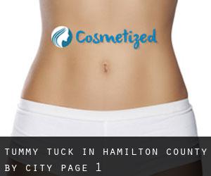 Tummy Tuck in Hamilton County by city - page 1