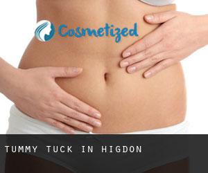 Tummy Tuck in Higdon