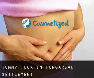 Tummy Tuck in Hungarian Settlement