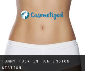Tummy Tuck in Huntington Station