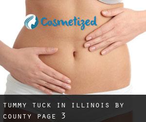 Tummy Tuck in Illinois by County - page 3