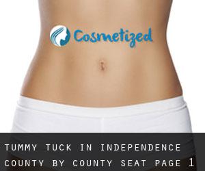 Tummy Tuck in Independence County by county seat - page 1