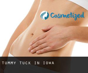 Tummy Tuck in Iowa Tummy Tuck in Iowa