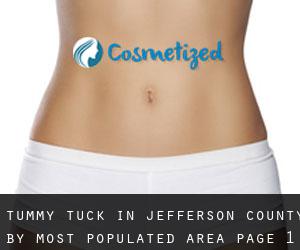 Tummy Tuck in Jefferson County by most populated area - page 1