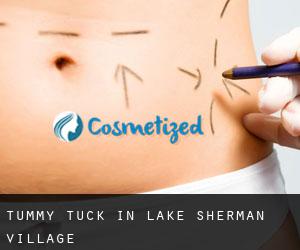 Tummy Tuck in Lake Sherman Village