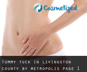 Tummy Tuck in Livingston County by metropolis - page 1
