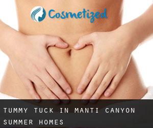Tummy Tuck in Manti Canyon Summer Homes