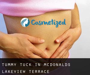 Tummy Tuck in McDonalds Lakeview Terrace