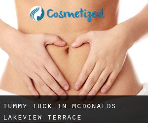 Tummy Tuck in McDonalds Lakeview Terrace
