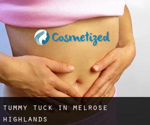 Tummy Tuck in Melrose Highlands