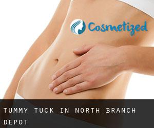 Tummy Tuck in North Branch Depot