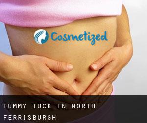Tummy Tuck in North Ferrisburgh