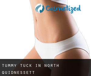 Tummy Tuck in North Quidnessett