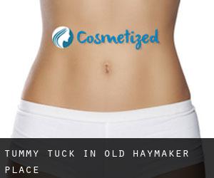Tummy Tuck in Old Haymaker Place