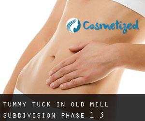 Tummy Tuck in Old Mill Subdivision Phase 1-3
