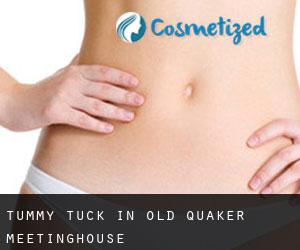 Tummy Tuck in Old Quaker Meetinghouse