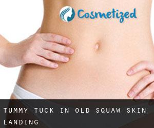 Tummy Tuck in Old Squaw Skin Landing