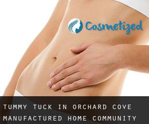 Tummy Tuck in Orchard Cove Manufactured Home Community