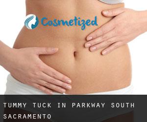Tummy Tuck in Parkway-South Sacramento