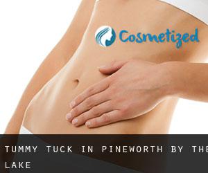 Tummy Tuck in Pineworth by the Lake