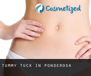 Tummy Tuck in Ponderosa