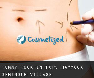 Tummy Tuck in Pops Hammock Seminole Village
