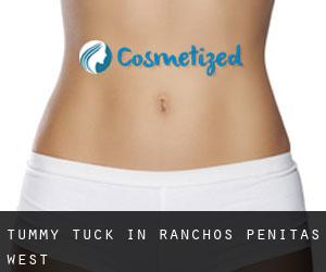 Tummy Tuck in Ranchos Penitas West
