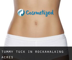 Tummy Tuck in Rockawalking Acres