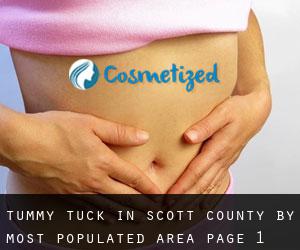 Tummy Tuck in Scott County by most populated area - page 1