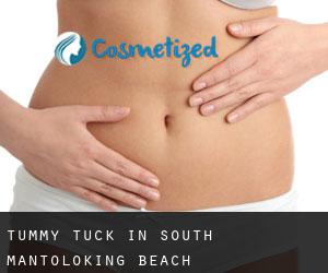 Tummy Tuck in South Mantoloking Beach
