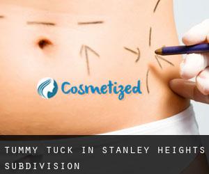 Tummy Tuck in Stanley Heights Subdivision