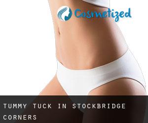 Tummy Tuck in Stockbridge Corners