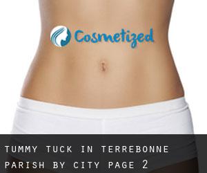 Tummy Tuck in Terrebonne Parish by city - page 2