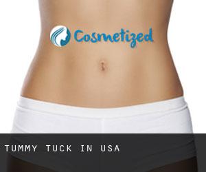 Tummy Tuck in USA