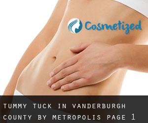 Tummy Tuck in Vanderburgh County by metropolis - page 1