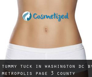Tummy Tuck in Washington, D.C. by metropolis - page 3 (County) (Washington, D.C.)
