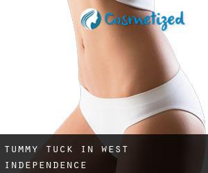 Tummy Tuck in West Independence