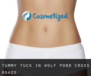 Tummy Tuck in Wolf Pond Cross Roads