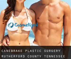 Canebrake plastic surgery (Rutherford County, Tennessee)