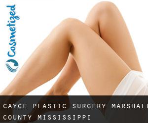 Cayce plastic surgery (Marshall County, Mississippi)