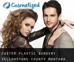Custer plastic surgery (Yellowstone County, Montana)