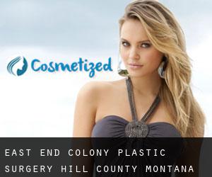 East End Colony plastic surgery (Hill County, Montana)