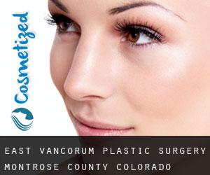 East Vancorum plastic surgery (Montrose County, Colorado)