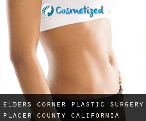 Elders Corner plastic surgery (Placer County, California)